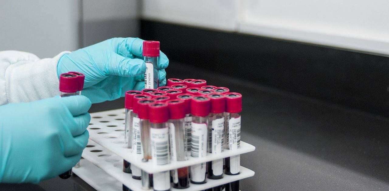 person wear gloves sorting blood vials